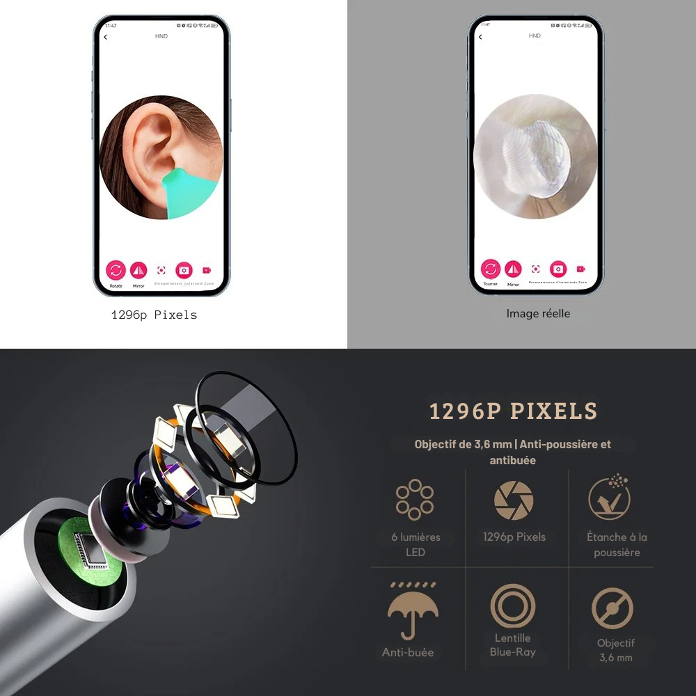 Nettoyeur d'oreilles intelligent avec caméra