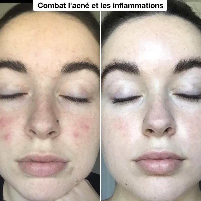 Sculpteur Visage & Cou