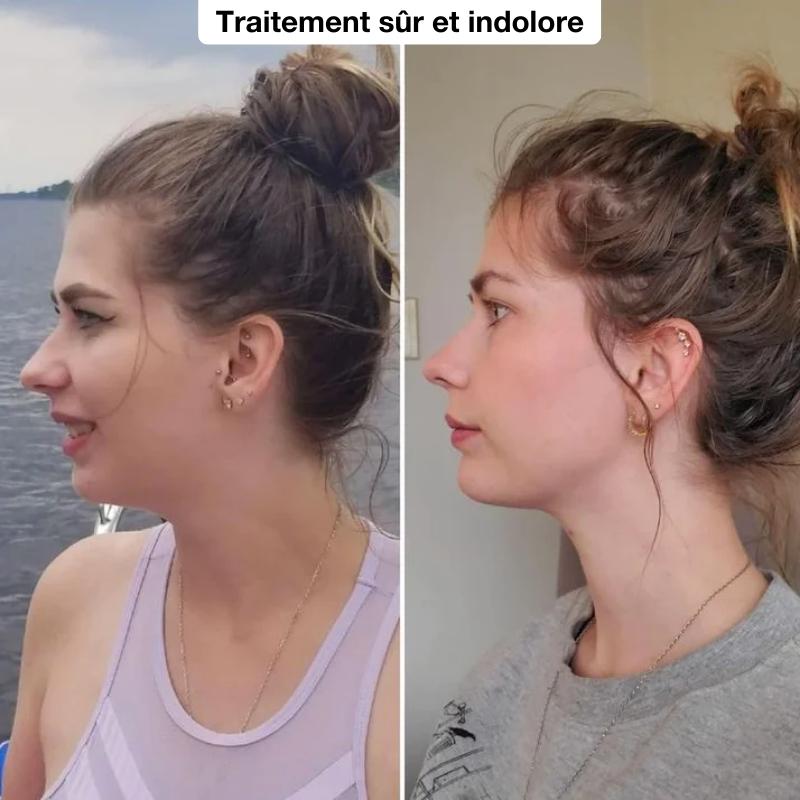 Sculpteur Visage & Cou