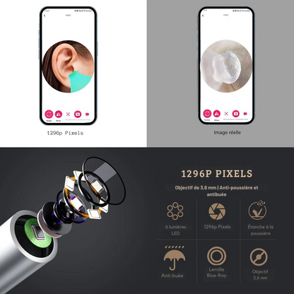 Nettoyeur d'oreilles intelligent avec caméra